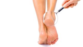 Trockene Füße – was können Sie tun, um sie zu regenerieren?